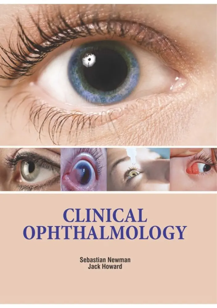 Clinical Ophthalmology Guide – Newman – Isbn 9781788824453 – Medplus 1